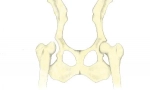 Displeje bedrových kĺbov u psov: diagnóza, liečba a prognózy