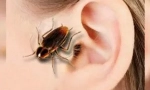 Tracakan v uchu: symptómy a extrakcia