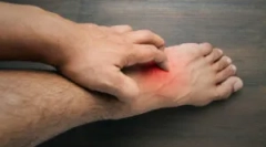 Alergia na uhryznutie kvetu v človeku