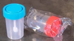 Analýza vajec na vajcia