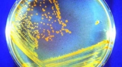 Nesmrteľné zvieratá, ktoré nás všetkých prežijú