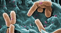 Čo sa eukaryotes líšia od prokaryot?