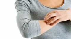 Ako nebezpečné blchy pre človeka?