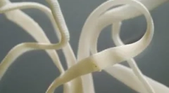 Ako nebezpečné pásky červy u ľudí a ich príznaky