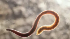 Aké sú stožiare a ich liečba