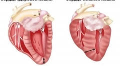 Čo je hypertrofická kardiomyopatia u mačiek a to, čo je nebezpečné
