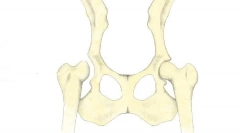 Displeje bedrových kĺbov u psov: diagnóza, liečba a prognózy
