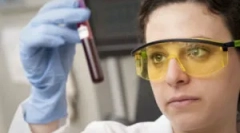 Ako sa krvný test vykonáva na toxoplazmóze