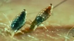 Čo vši bites vyzerajú?