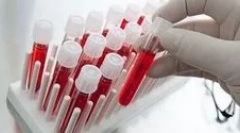 Aké krvné testy na parazitoch musia prejsť?