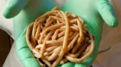 Čo červy žijú v ľudskom tele