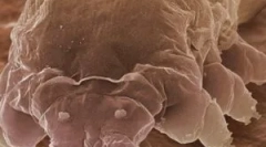 Roztočový demodux a vlastnosti jeho živobytie