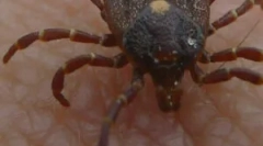 Magnican monocytarian erlihiosis