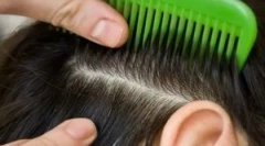 Liečba pediculosise doma
