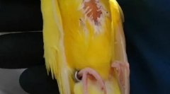 Papaot na lipóm, príčiny, liečba