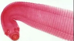 Najbežnejšie druhy červov u ľudí