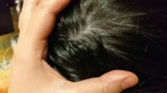 Ľudové domáce opravné prostriedky z vši a gid