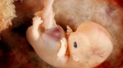 Ontogenéza a inherentné vzory