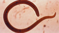 Nebezpečné červy