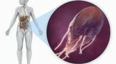 Sila a diéta s giardiasisom