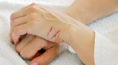 Prečo mačky bojujú