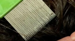 Postup dokončenia vši a nd