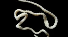 Široký lenthec u ľudí: liečba a symptómy