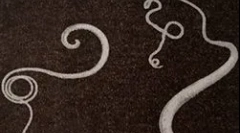 Symptómy a liečba infekcie s výkonom