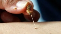 Finančné prostriedky z uk