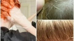 Má vši vlasy farby zabije?