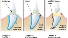 Domáce predátor starostlivosti - cattick čistenie