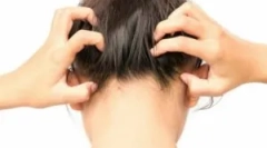 Druhy parazitického hmyzu v hlave muža