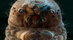 Názory na parazity žijúce v ľudskom tele