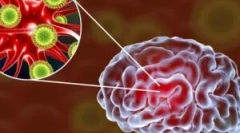 Vírusová encefalitída mozgu: druhy a príznaky