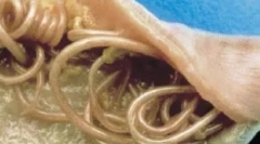 Vnútorné parazity (endoparazity)