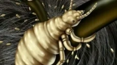 Vši a ich inkubačná doba