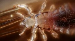 Vši ako nosiče ochorenia